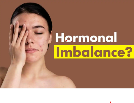 Hormonal Imbalance | edtechreader