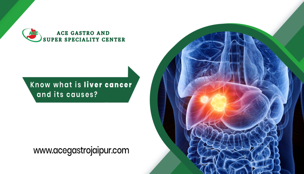 liver cancer | edtechreader